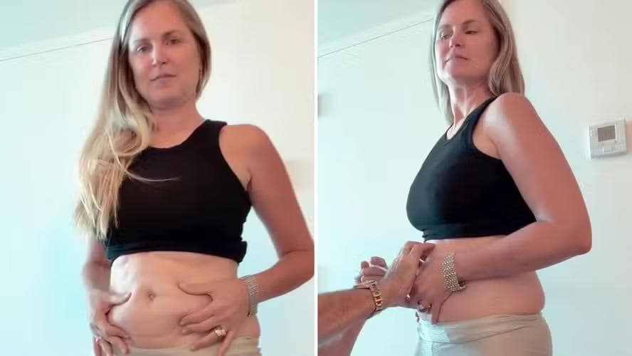 Susana Werner inicia tratamento com caneta emagrecedora — Foto: Reprodução/Instagram